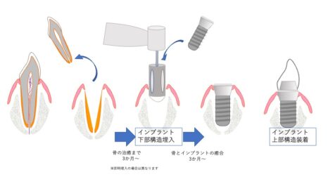 顎顔面の障害の回復3