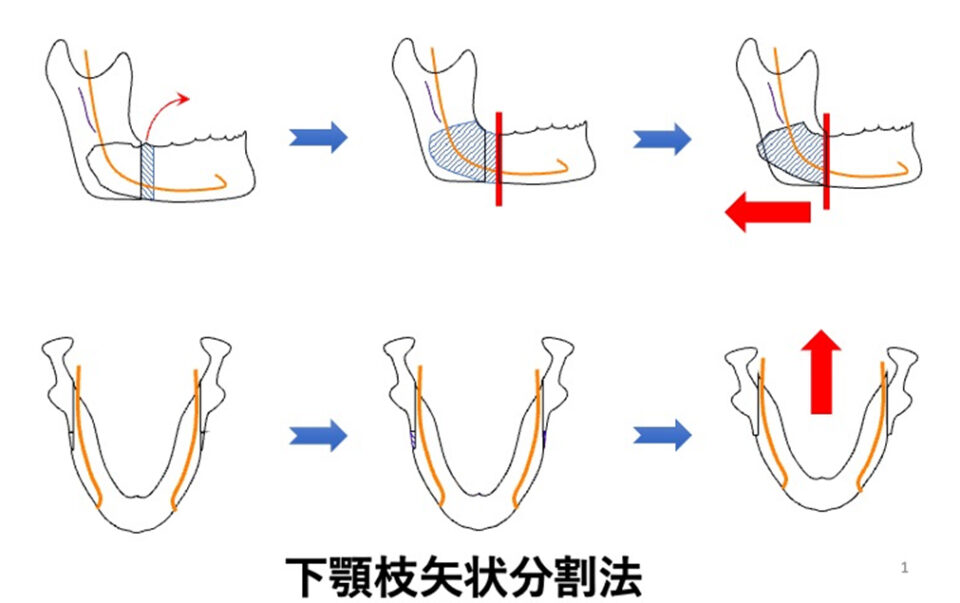 口腔顎顔面外科疾患2