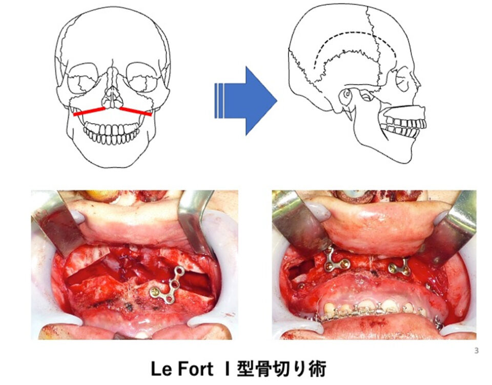 口腔顎顔面外科疾患3