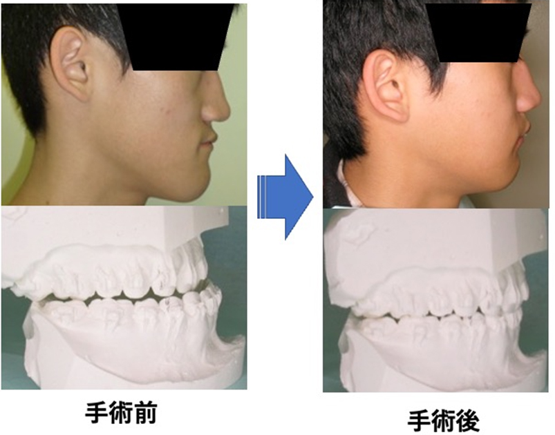 口腔顎顔面外科疾患1
